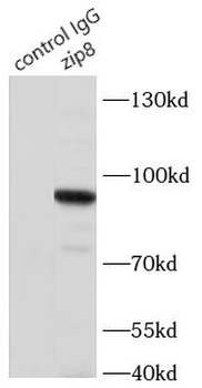 SLC39A8 Rabbit Polyclonal Antibody