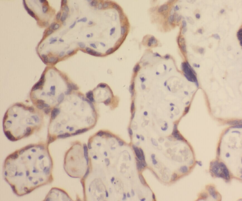 SLC39A8 Rabbit Polyclonal Antibody