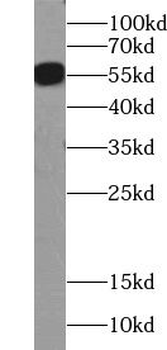 ZMPSTE24 Rabbit Polyclonal Antibody