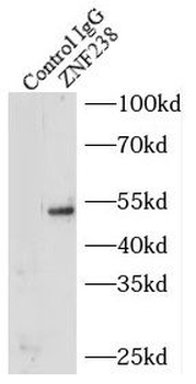 ZBTB18 Antibody