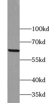 ZNF395 Antibody