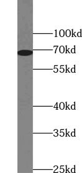 ZNF410 Antibody