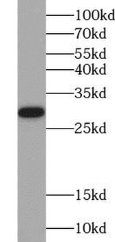 ZNF740 Rabbit Polyclonal Antibody