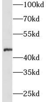 ZP3 Rabbit Polyclonal Antibody