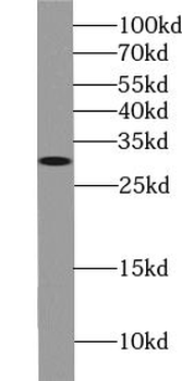 ZWINT Rabbit Polyclonal Antibody