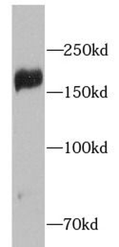IRS2 Antibody