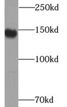 CD163 Antibody
