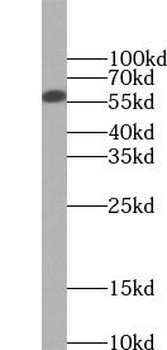 FTO Rabbit Polyclonal Antibody