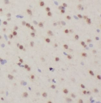 FTO Rabbit Polyclonal Antibody
