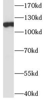 ITIH4 Rabbit Polyclonal Antibody