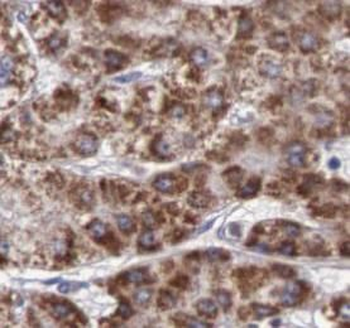 ITIH4 Rabbit Polyclonal Antibody