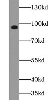 Phospho FGFR2 (ser782) Rabbit Polyclonal Antibody