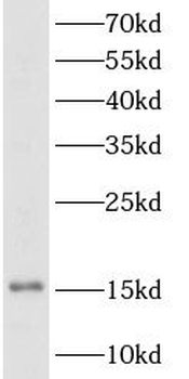 TSHB Rabbit Polyclonal Antibody