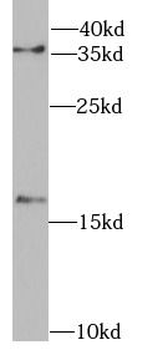 FHIT Rabbit Polyclonal Antibody