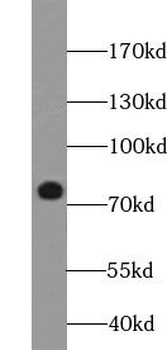 MAP3K3 Rabbit Polyclonal Antibody