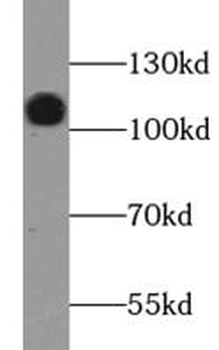 LAMP2 Antibody