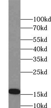 NPPA Antibody