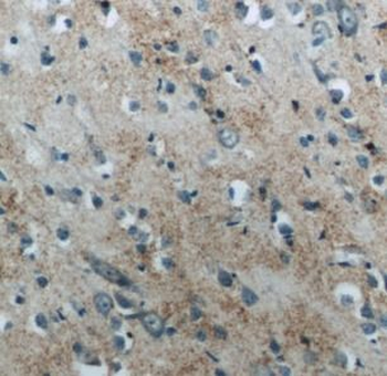 NPPB Rabbit Polyclonal Antibody