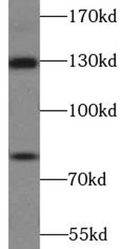 AMOT Rabbit Polyclonal Antibody