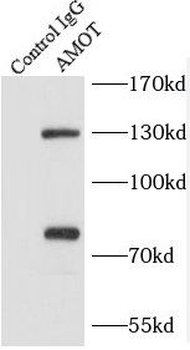 AMOT Rabbit Polyclonal Antibody
