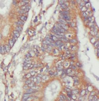 AMOT Rabbit Polyclonal Antibody