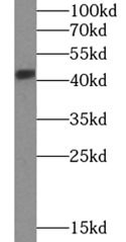 SH3GL1 Rabbit Polyclonal Antibody
