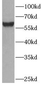 SLC2A2 Rabbit Polyclonal Antibody