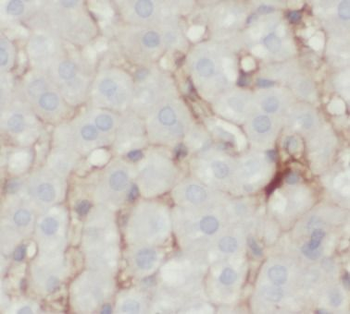 SLC2A2 Rabbit Polyclonal Antibody