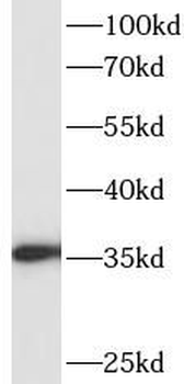 NOSIP Antibody