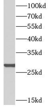 PSMG2 Rabbit Polyclonal Antibody