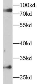 C1R Rabbit Polyclonal Antibody