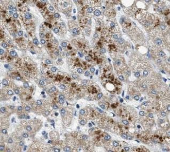 C1R Rabbit Polyclonal Antibody