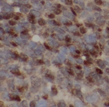 PELP1 Rabbit Polyclonal Antibody