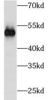 TUBB3 Antibody