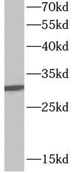 SFN Rabbit Polyclonal Antibody