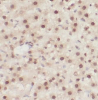 SFN Rabbit Polyclonal Antibody