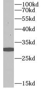 CASP14 Rabbit Polyclonal Antibody