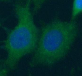 CASP14 Rabbit Polyclonal Antibody