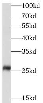 GSTM1 Rabbit Polyclonal Antibody