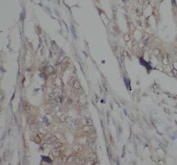 GSTM1 Rabbit Polyclonal Antibody
