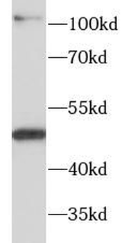 SLC16A1 Rabbit Polyclonal Antibody