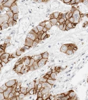 SLC16A1 Rabbit Polyclonal Antibody