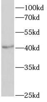 QPCT Rabbit Polyclonal Antibody