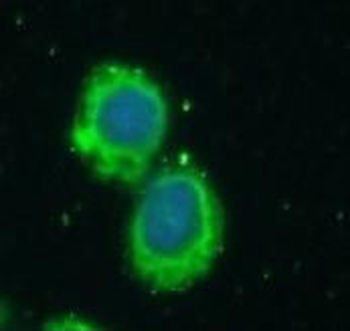 ATP2A2 Rabbit Polyclonal Antibody