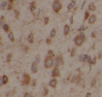 ATP2A2 Rabbit Polyclonal Antibody