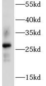 AQP2 Antibody