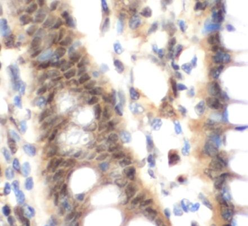 SOCS1 Antibody
