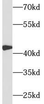 CFHR3 Rabbit Polyclonal Antibody