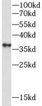 CTLA4 Antibody