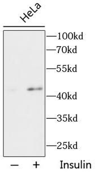 Phospho AKT1S1 (T246) Rabbit Polyclonal Antibody
